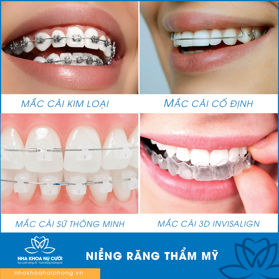 nieng-rang-tham-my