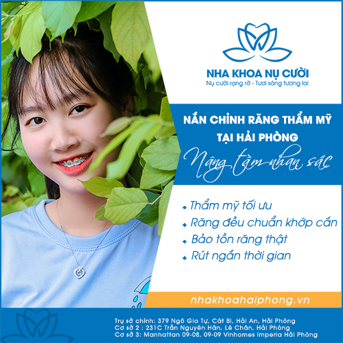 NẮN CHỈNH RĂNG THẨM MỸ TẠI HẢI PHÒNG