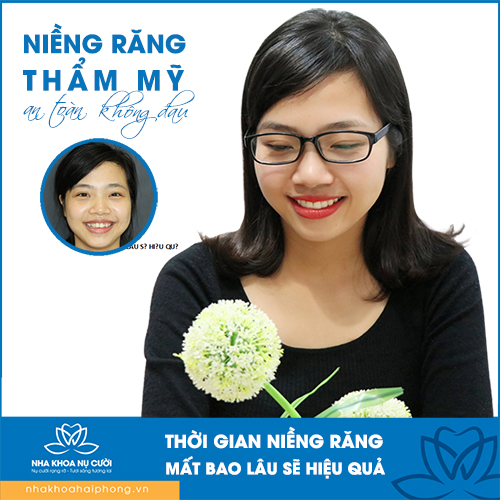 THỜI GIAN NIỀNG RĂNG MẤT BAO LÂU SẼ HIỆU QUẢ
