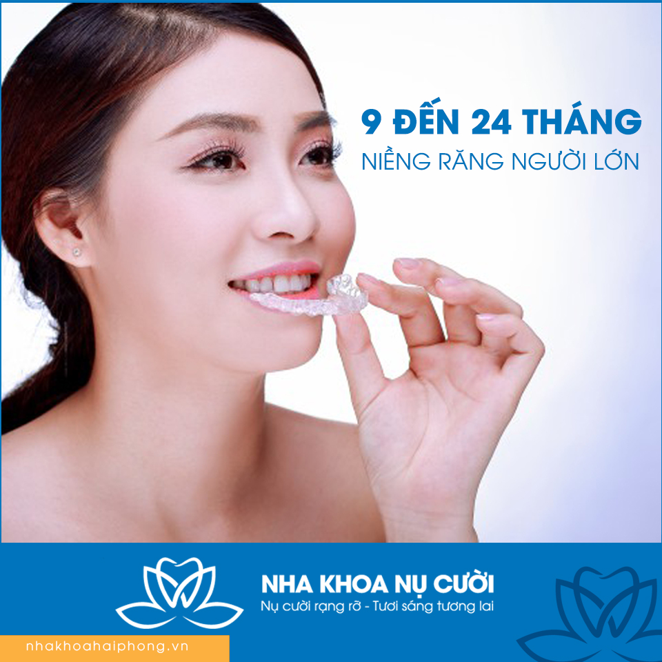 thoi-gian-nieng-rang-mat-bao-lau-se-hieu-qua