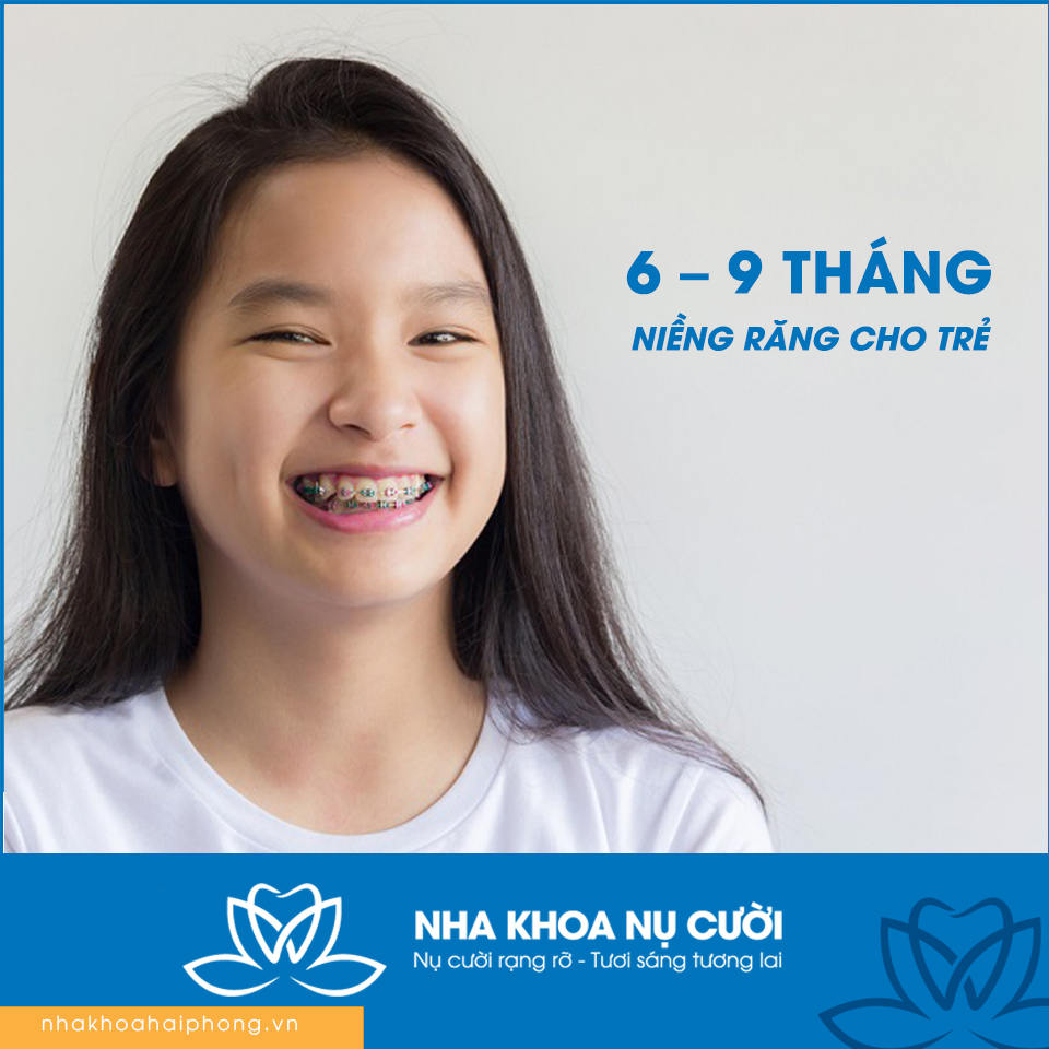 thoi-gian-nieng-rang-mat-bao-lau-se-hieu-qua