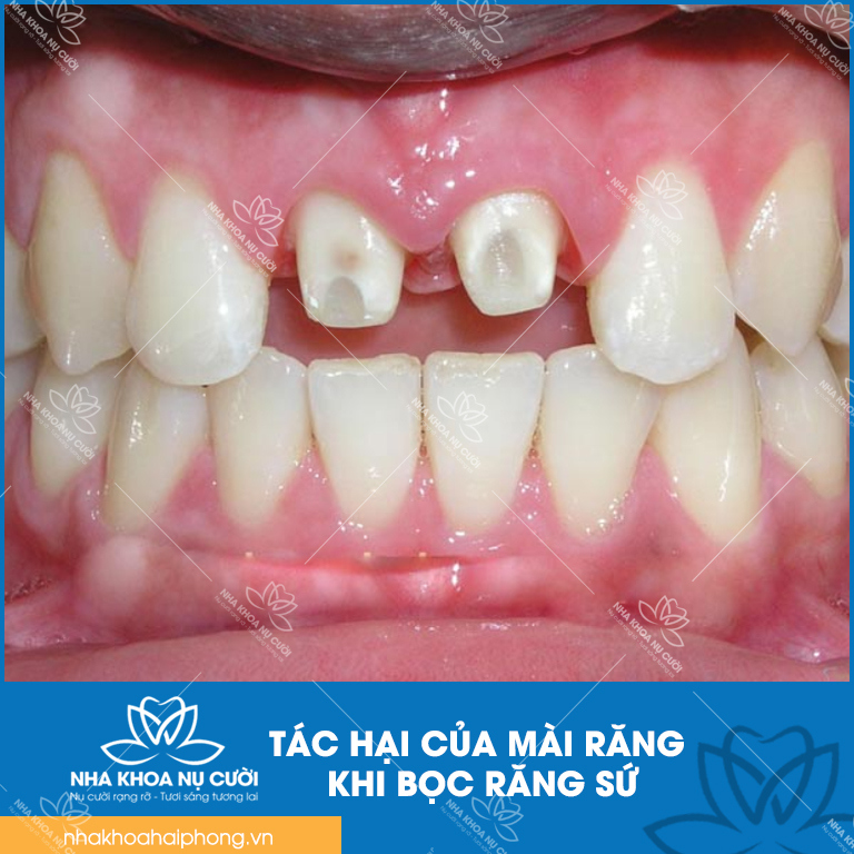 mai-rang