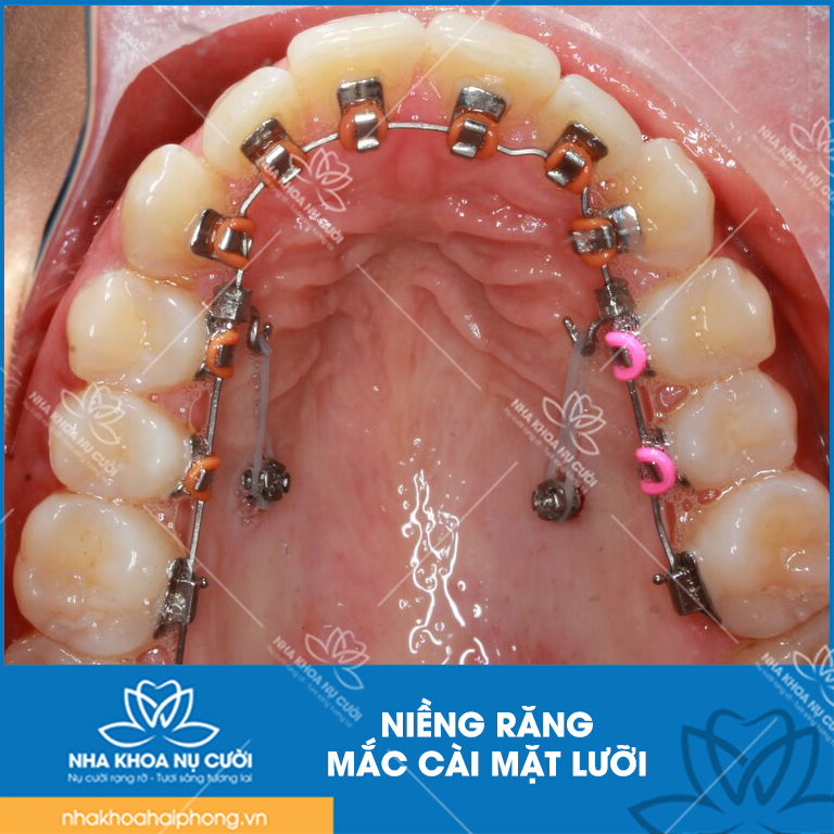 mac-cai-mat-trong