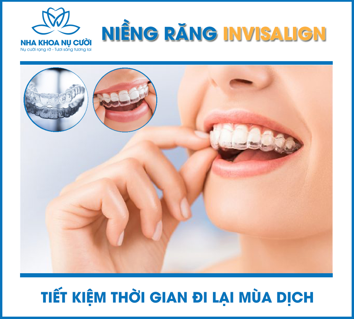 uu-diem-cua-nieng-rang-3D