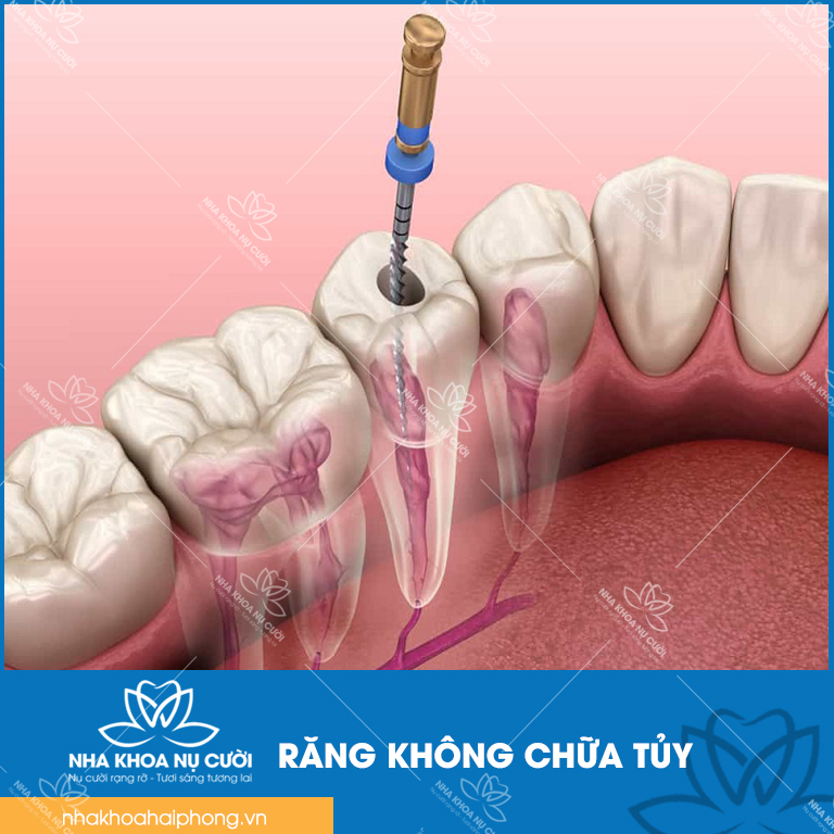 rang-khong-chua-tuy