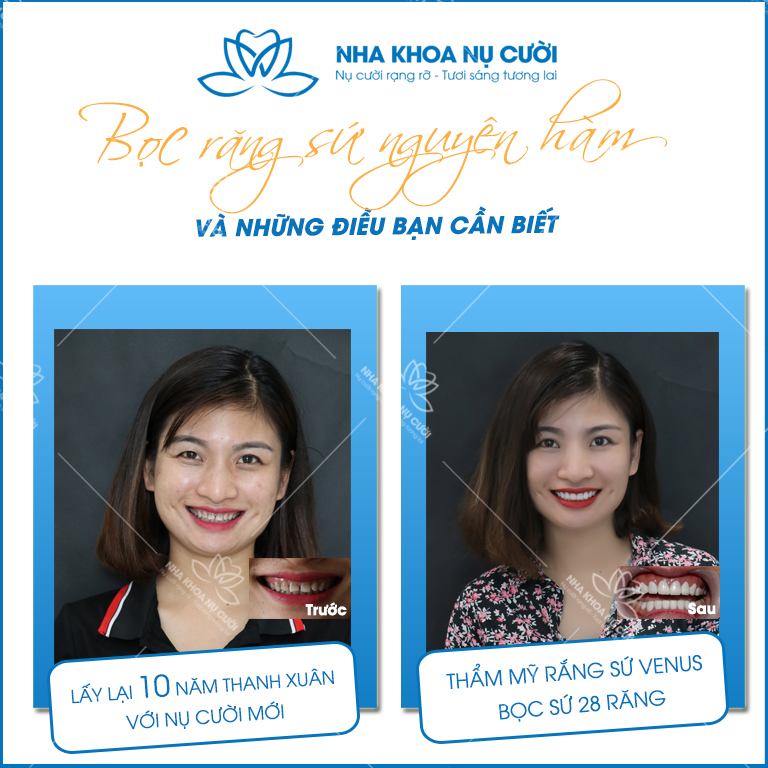 Chương trình khuyến mãi