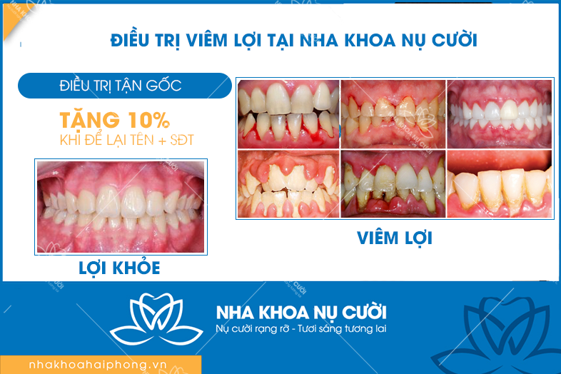 Chương trình khuyến mãi