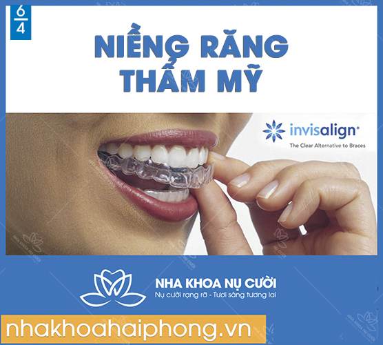 NIỀNG RĂNG THẨM MỸ TẠI HẢI PHÒNG