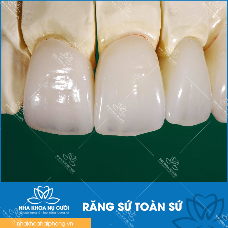 rang-toan-su