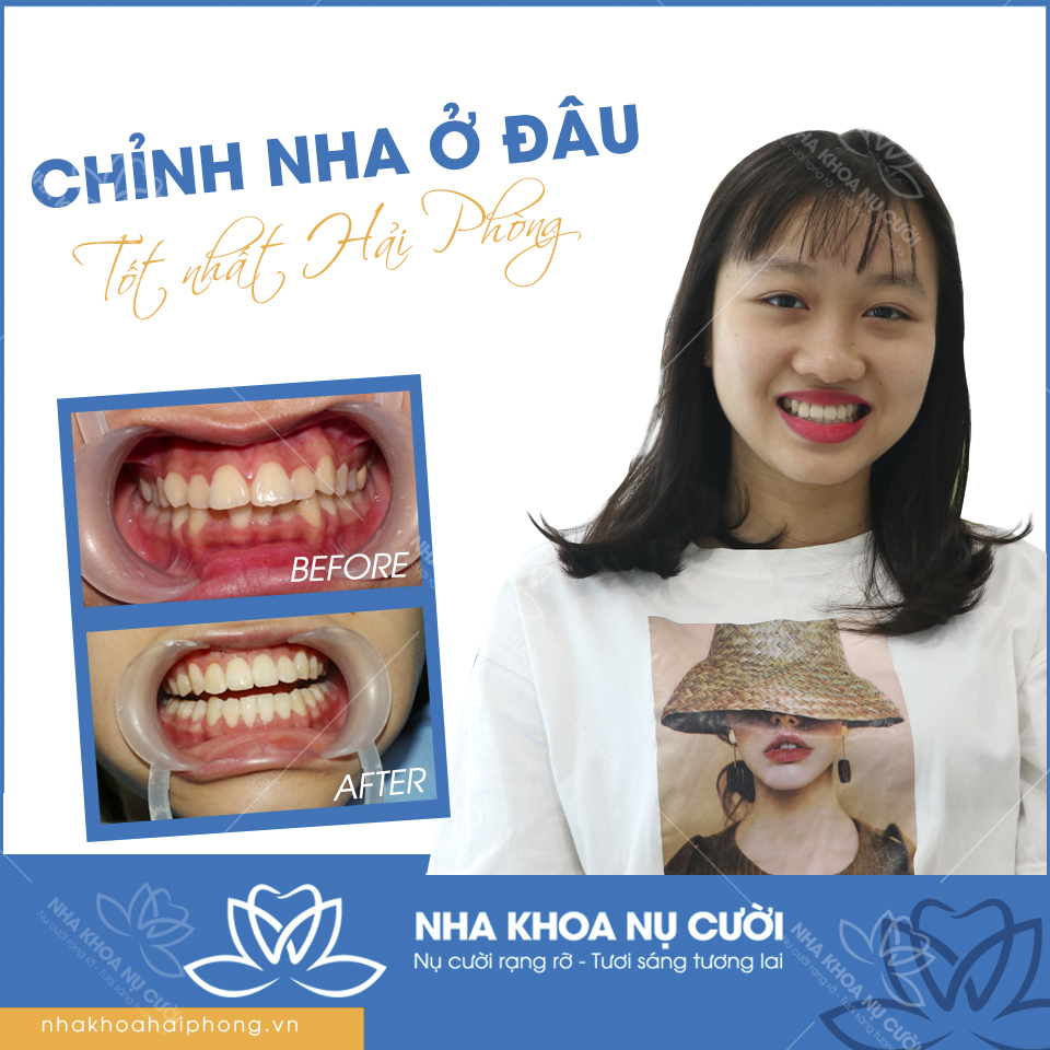 chinh-nh-o-sau-tot