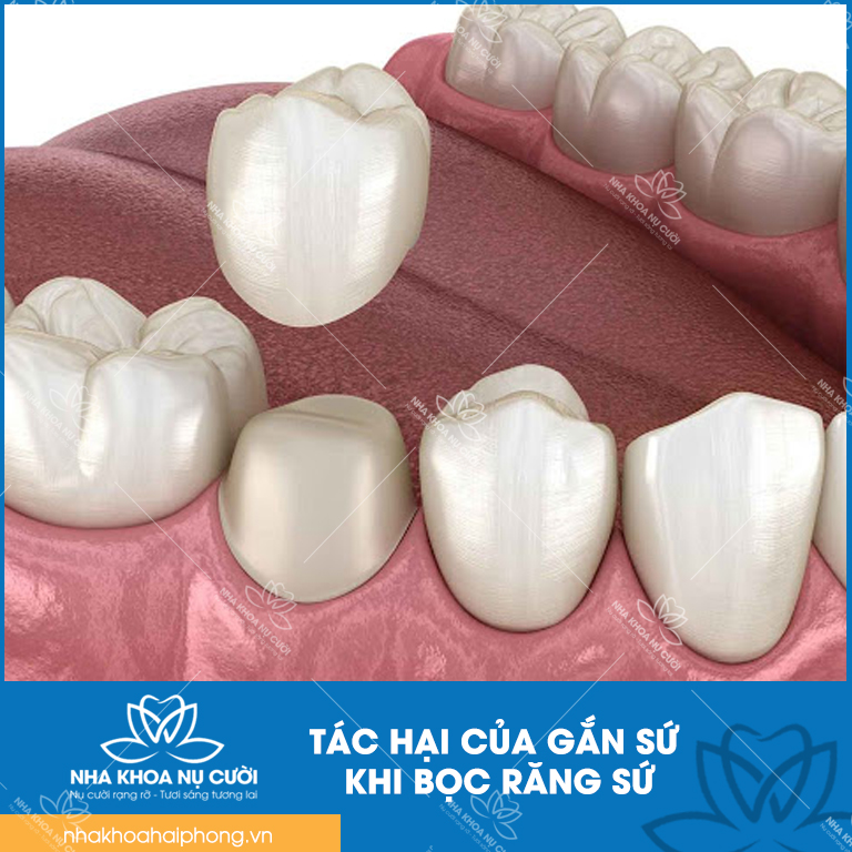boc-rang-su-co-hai-khong