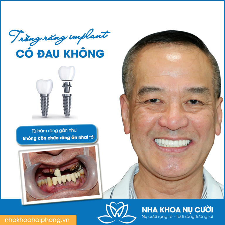 Chương trình khuyến mãi