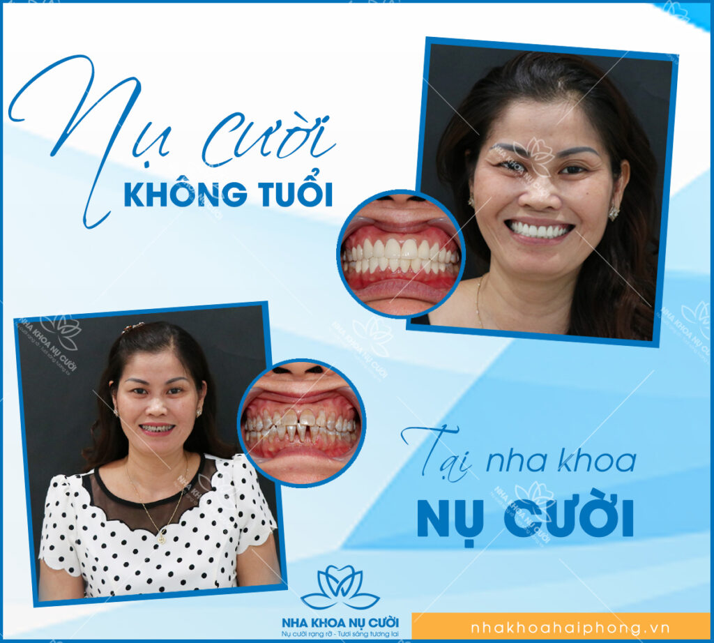 Khach-hang