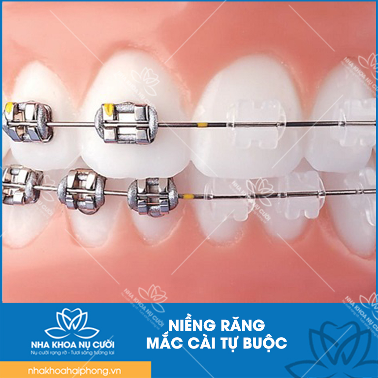 mac-cai-tu-dong