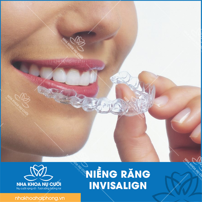 nieng-rang-invisalign