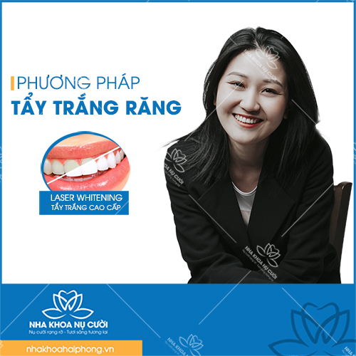 NHỮNG ĐIỀU CẦN BIẾT VỀ TẨY TRẮNG RĂNG