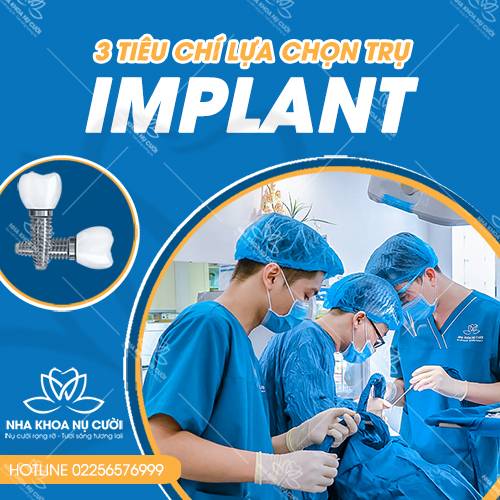 3 TIÊU CHÍ LỰA CHỌN TRỤ IMPLANT KHI TRỒNG RĂNG