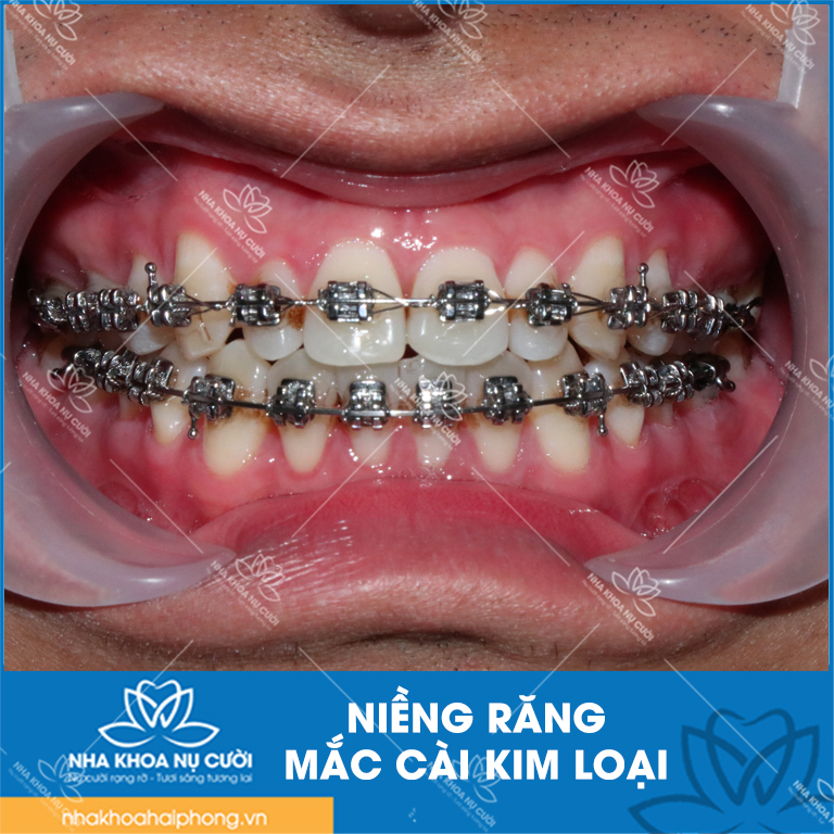 Nieng-rang-mac-cai-kim-loai-phuong-phap-nieng-rang-truyen-thong