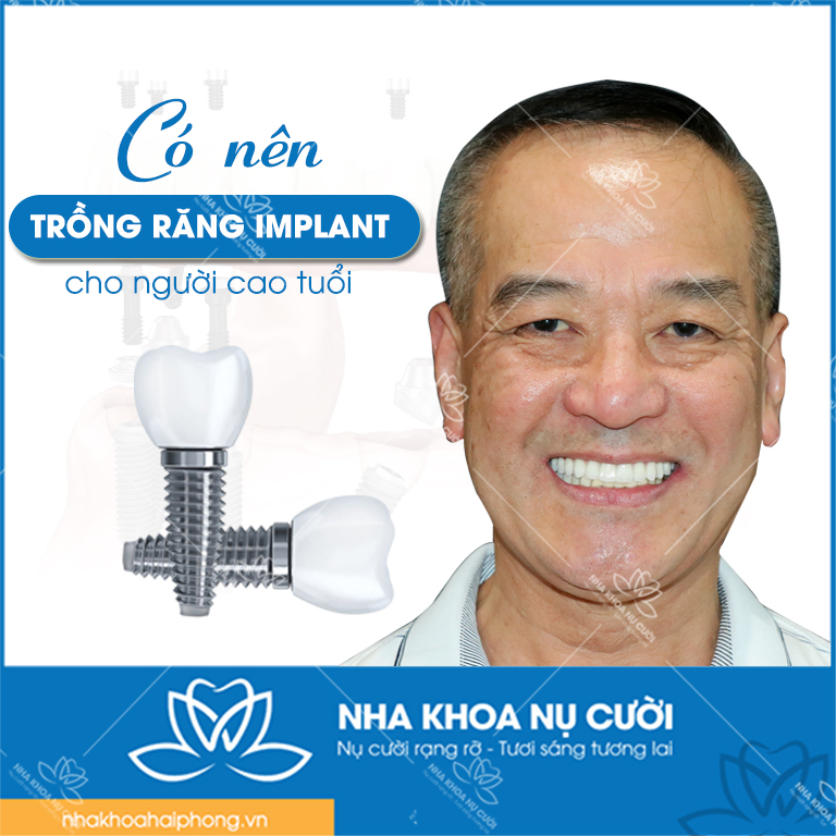 trong-rang-implant-cho-nguoi-cao-tuoi