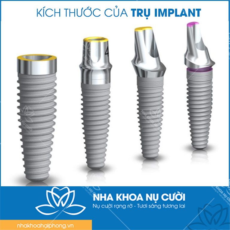 3-tieu-chi-lua-chon-tru-Implant-khi-trong-rang