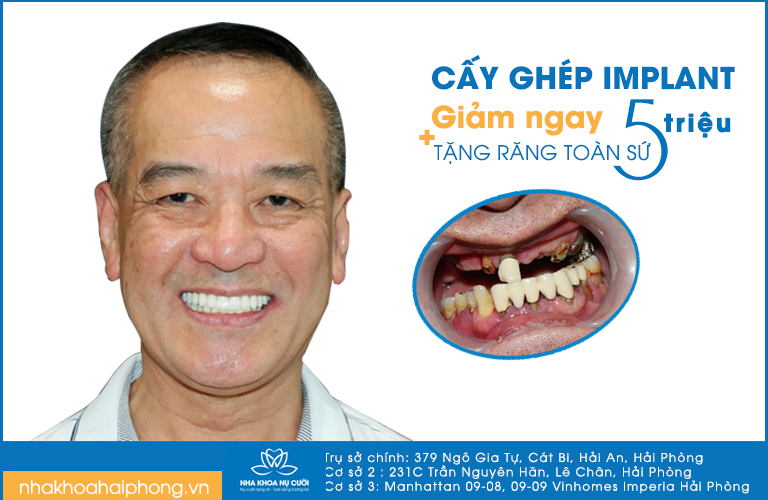 thang-vang-nha-khoa-nu-cuoi-khai-truong-co-so-3-uu-dai-cuc-soc