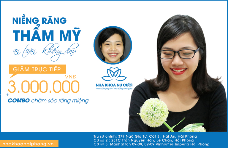 thang-vang-nha-khoa-nu-cuoi-khai-truong-co-so-3-uu-dai-cuc-soc