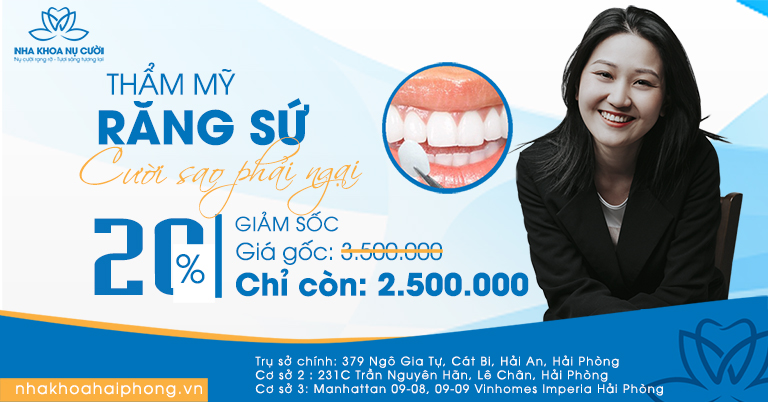 thang-vang-nha-khoa-nu-cuoi-khai-truong-co-so-3-uu-dai-cuc-soc