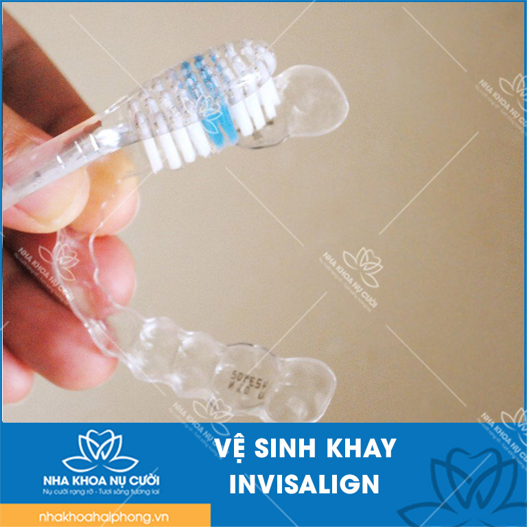 Nieng-rang-trong-suot-Invisalign