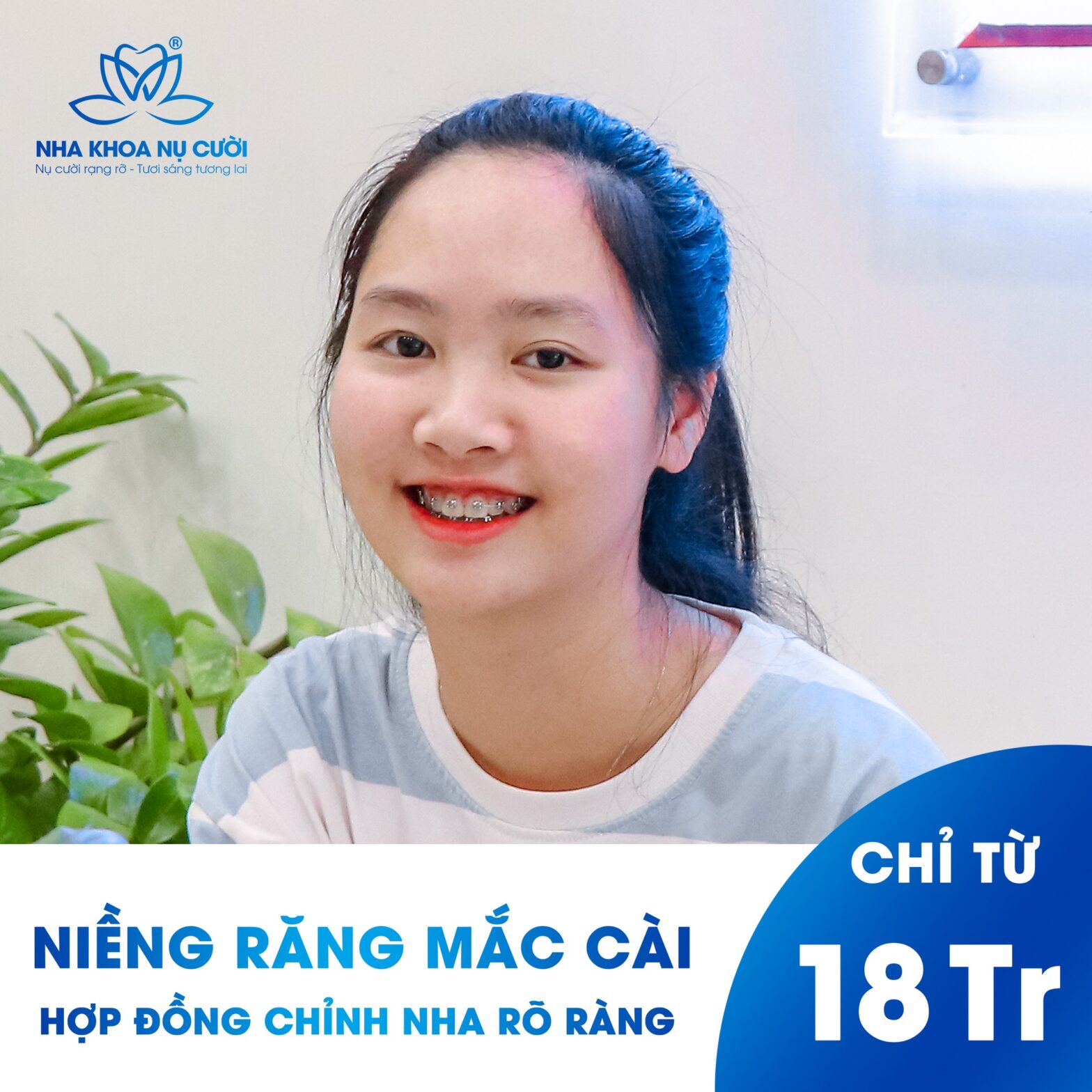 NHỮNG ĐIỀU CẦN BIẾT TRƯỚC KHI CHỈNH NHA TẠI NHA KHOA NỤ CƯỜI