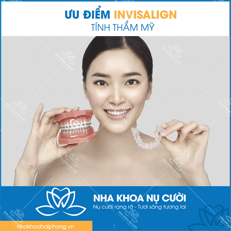 Uu-diem-cua-Invisalign