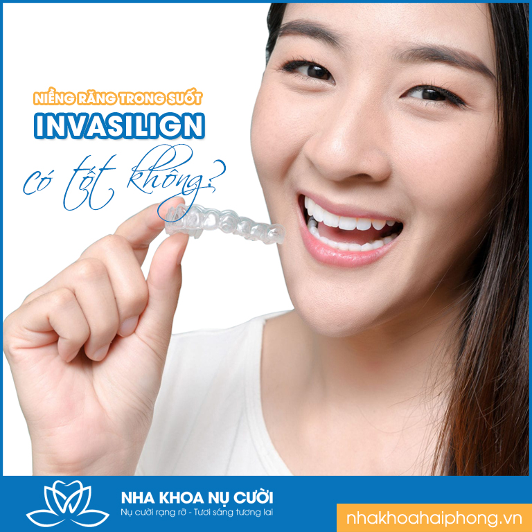 nieng-răng-trong-suot-invisalign-co-tot-khong