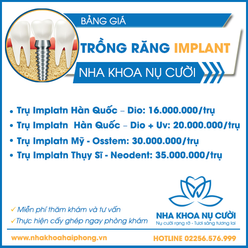 gia-trong-rang-Implant-tai-nha-khoa-nu-cuoi