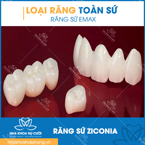 cac-loai-rang-toan-su-cua-nha-khoa-nu-cuoi
