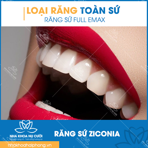 cac-loai-rang-toan-su-cua-nha-khoa-nu-cuoi