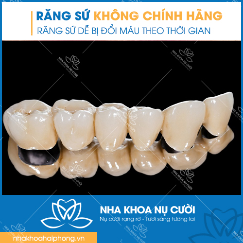 rang-su-khong-chinh-hang