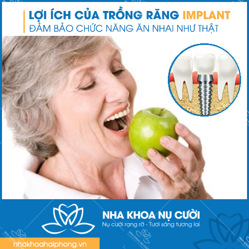 loi-ich-cua-trong-rang-Implant