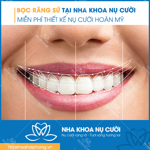 boc-chup-rang-su-tham-my-tai-Hai-Phong