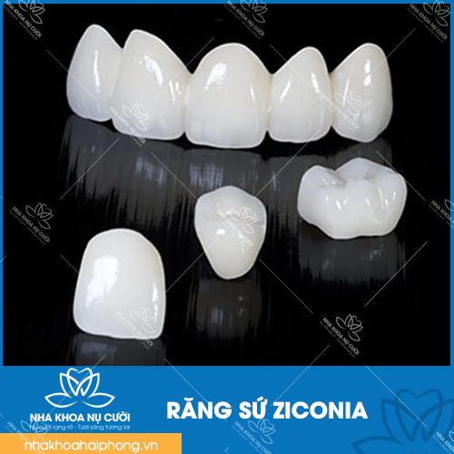 cac-loai-rang-toan-su-cua-nha-khoa-nu-cuoi