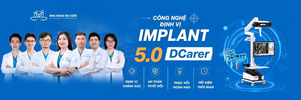 baner-implant