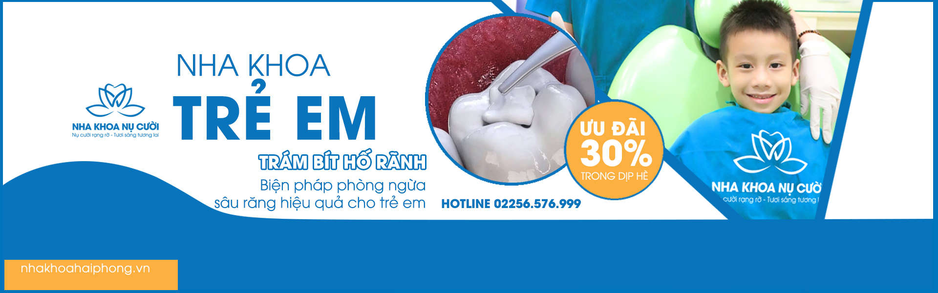 TRÁM BÍT HỐ RÃNH PHÒNG NGỪA SÂU RĂNG HIỆU QUẢ CHO TRẺ