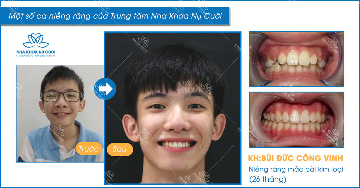 anh-khach-hang