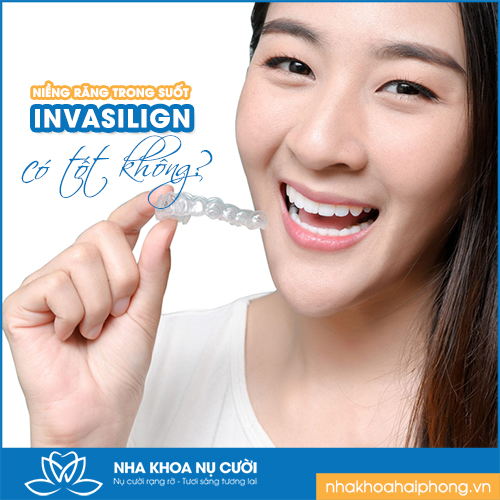 NIỀNG RĂNG TRONG SUỐT INVISALIGN CÓ TỐT KHÔNG ?