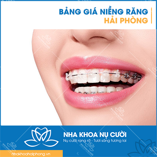 BẢNG GIÁ NIỀNG RĂNG HẢI PHÒNG 2026