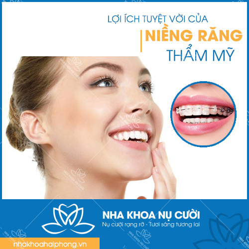NHỮNG LỢI ÍCH TUYỆT VỜI CỦA NIỀNG RĂNG THẨM MỸ