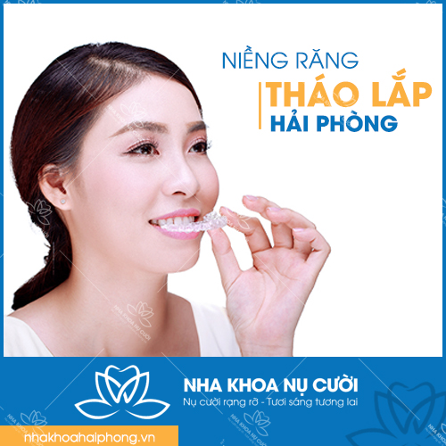 Niềng Răng Tháo Lắp Hải Phòng | Chi Phí, Hiệu Quả & Invisalign