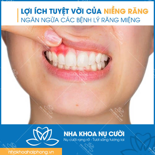 nhung-loi-ich-tuyet-voi-cua-nieng-rang-tham-my