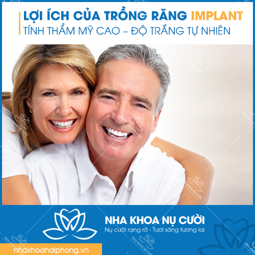 loi-ich-cua-trong-rang-Implant
