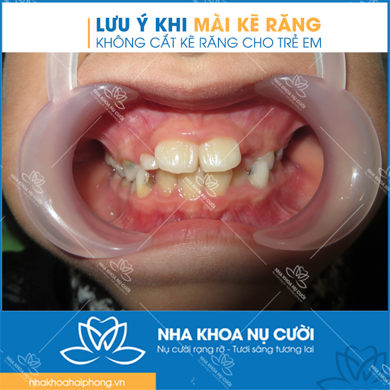 luu-y-khi-mai-ke -rang