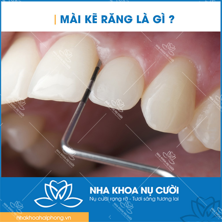 mai-ke-rang