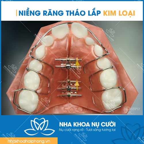 nieng-rang-thao-lap-kim-loai